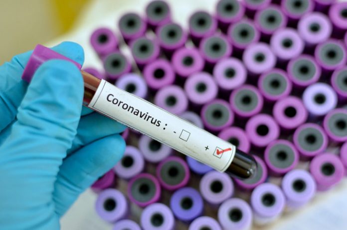 Coronavirus: les contaminations repartent à la hausse