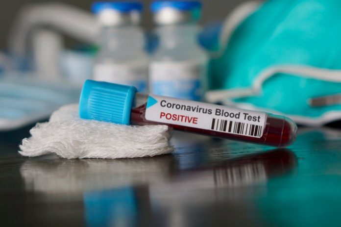 Coronavirus en Algérie - Nouveau bilan : 602 cas confirmés et 14 décès