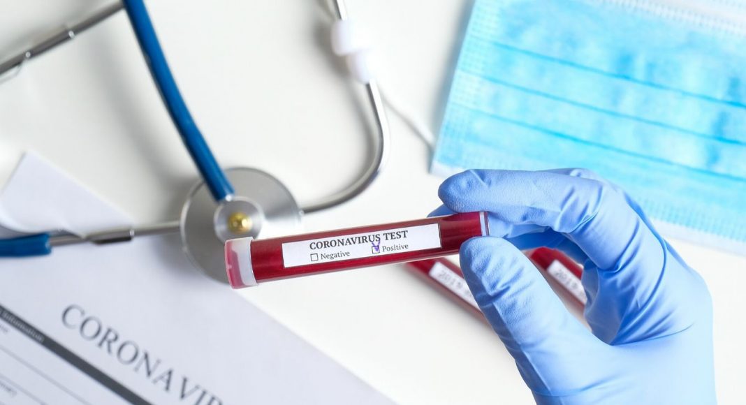 Coronavirus: les contaminations en baisse en Algérie