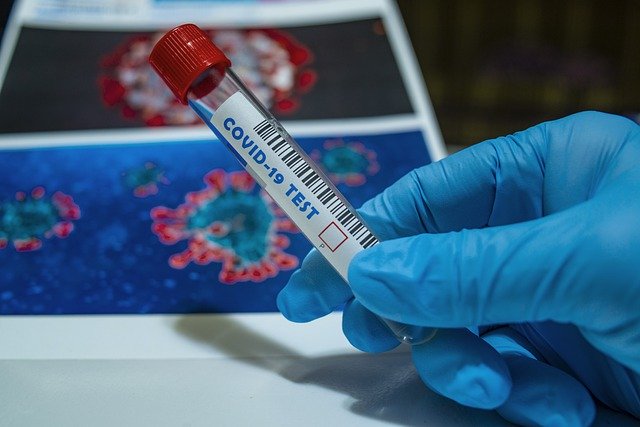 Coronavirus: près de 37 000 cas confirmés depuis l'apparition de la pandémie en Algérie