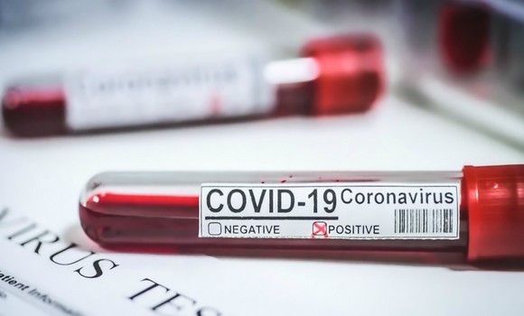 Coronavirus en Algérie: 104 nouveaux cas, 156 guéris et 9 décès en 24h
