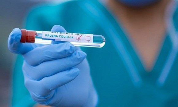 Coronavirus en Algérie: 1044 nouveaux cas en 24h