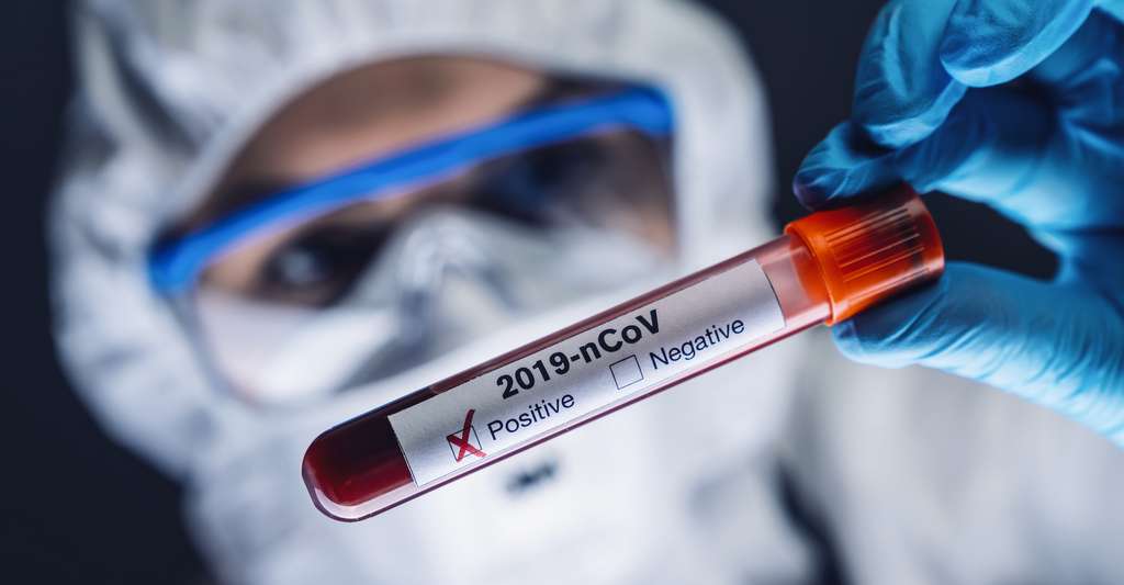 Covid-19: les prix des tests et analyses de dépistage du virus plafonnés