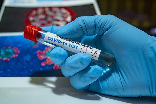 Dépistage Covid-19: les laboratoires privés autorisés à effectuer les tests PCR